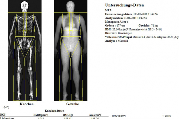 bodycomposition020EE2A92B-807A-470D-383B-864F72115558.jpg