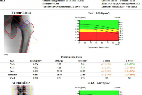 knochendichtemessung0239F3E20E-C493-91E1-0E6C-22DEA8FCC5C3.jpg