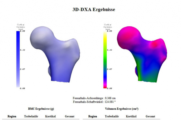 knochendichtemessung0398614A3A-1D42-A745-C321-548968E1CD4A.jpg